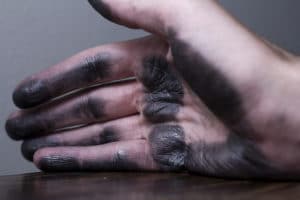 burned hand